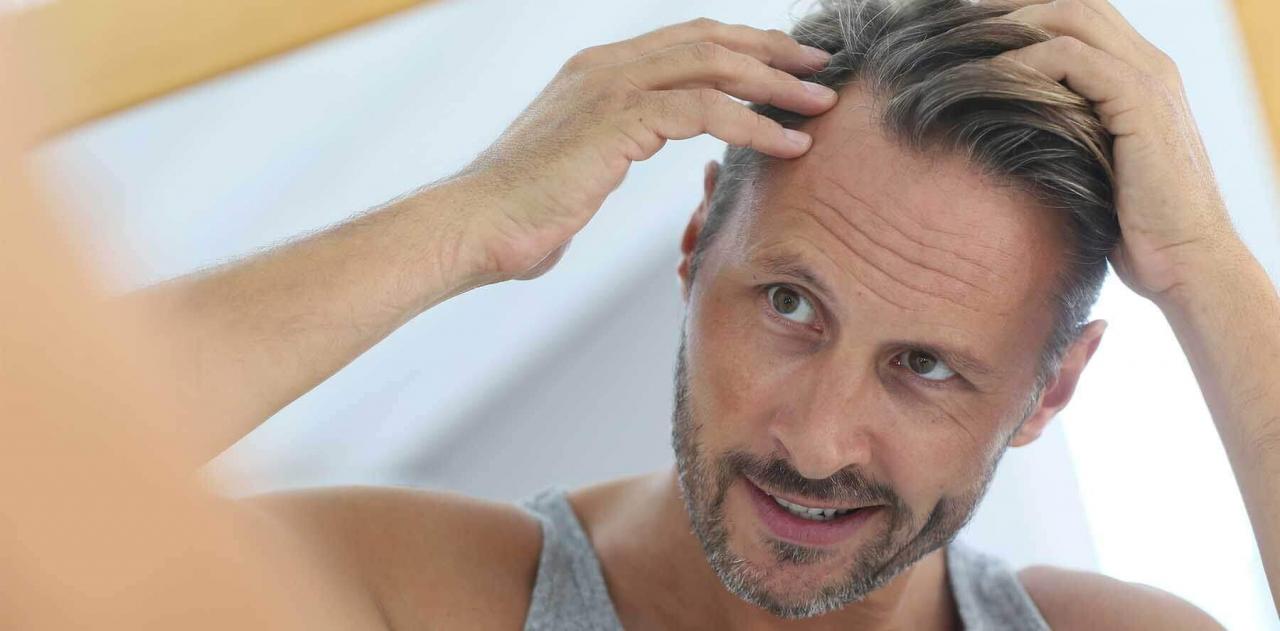 متى تثبت البصيلات بعد زراعة الشعر , مش هتقع متقلقش