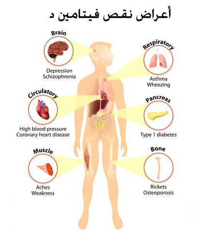 اعراض نقص فيتامين د , اكتشف اعراض نقص فيتامين د