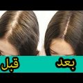147 3 علاج تساقط الشعر - افضل علاج للشعر نورهان خميس